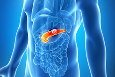 Scientists discover mechanism controlling spread of pancreatic cancer