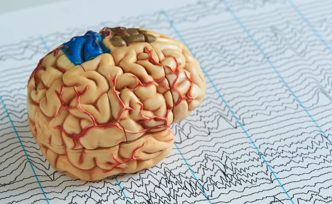 Mayo Clinic AI Uncovers Hidden Brain Patterns to Spot Early DementiaMayo Clinic researchers are using AI to improve the analysis of EEG tests, aiding early dementia detection.  By analyzing brain wave patterns more precisely, AI reveals subtle signs of cognitive decline that experts may miss. This development, based on data from over 11,000 patients, shows potential for EEGs to become a more accessible diagnostic tool for cognitive issues, especially in underserved areas.  Advancing EEG Analysis With AI and Machine Learning Mayo Clinic scientists are using artificial intelligence (AI) and machine learning to analyze electroencephalogram (EEG) tests more quickly and precisely, enabling neurologists to find early signs of dementia among data that typically go unexamined.  The century-old EEG, during which a dozen or more electrodes are stuck to the scalp to monitor brain activity, is often used to detect epilepsy. Its results are interpreted by neurologists and other experts trained to spot patterns among the test’s squiggly waves.