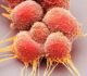 Scientists Discover Key to Stopping Aggressive Prostate Cancer Subtype